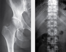 Bone Densitometry Problem Scanning & Analysis ASRT Approved 9 CEUS